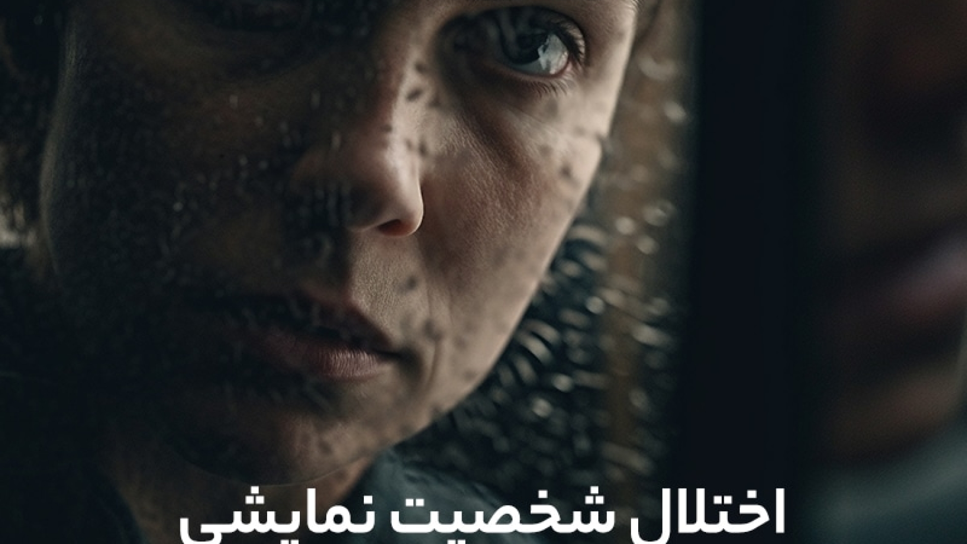 اختلال شخصیت نمایشی یا هیستریونیک چیست علائم و3 روش درمان قطعی